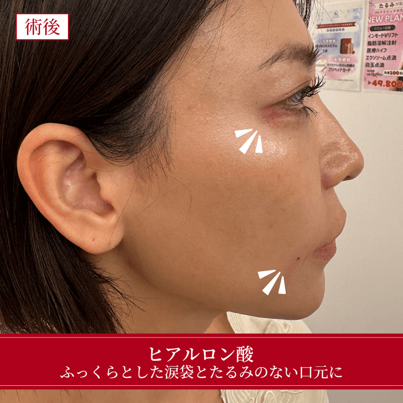 施術後