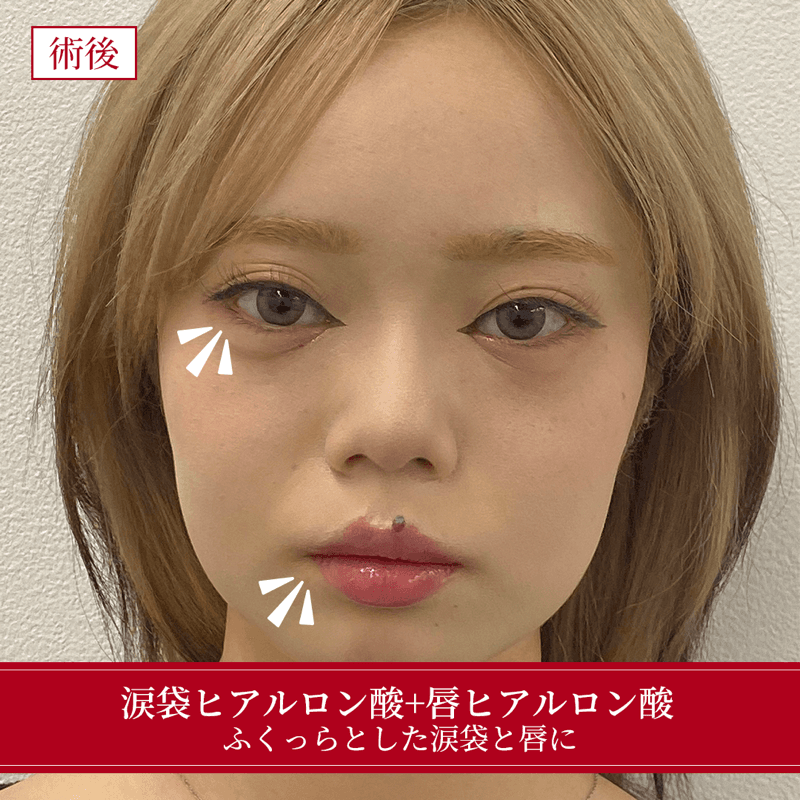 施術後