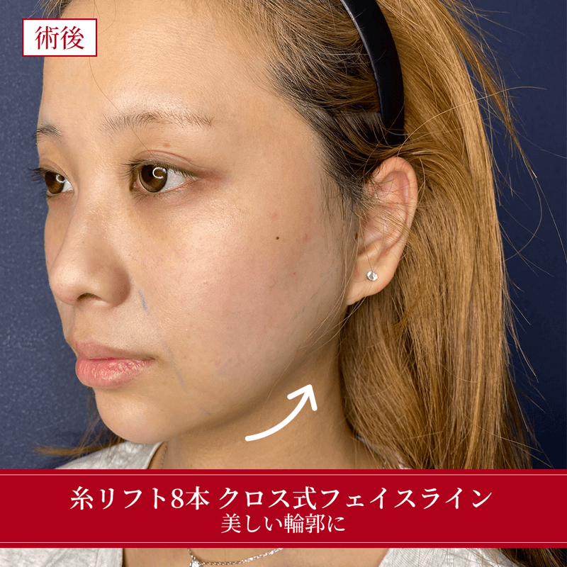 施術後