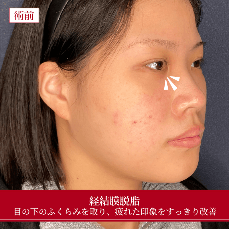 施術前